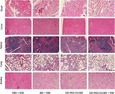 Oxidative stress induced by berberine-based mitochondria-targeted low temperature photothermal therapy